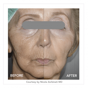 sculpt-e1611323911601
