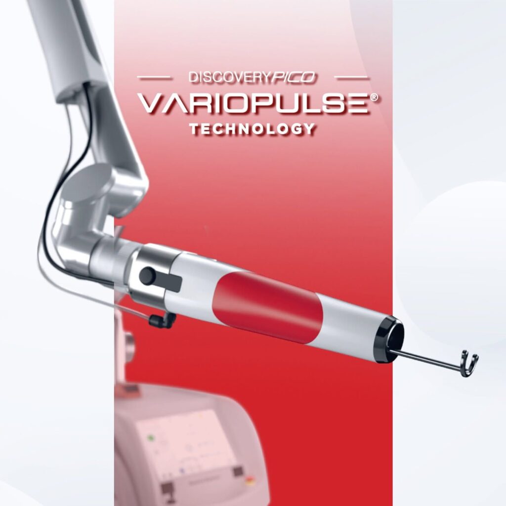 Công nghệ Discovery Pico - Ứng dụng & Ưu điểm vượt trội của Laser Pico trong thẩm mỹ 8 Tay cầm OPTIBEAM II mang đến nguồn năng lượng đồng nhất trên mỗi xung