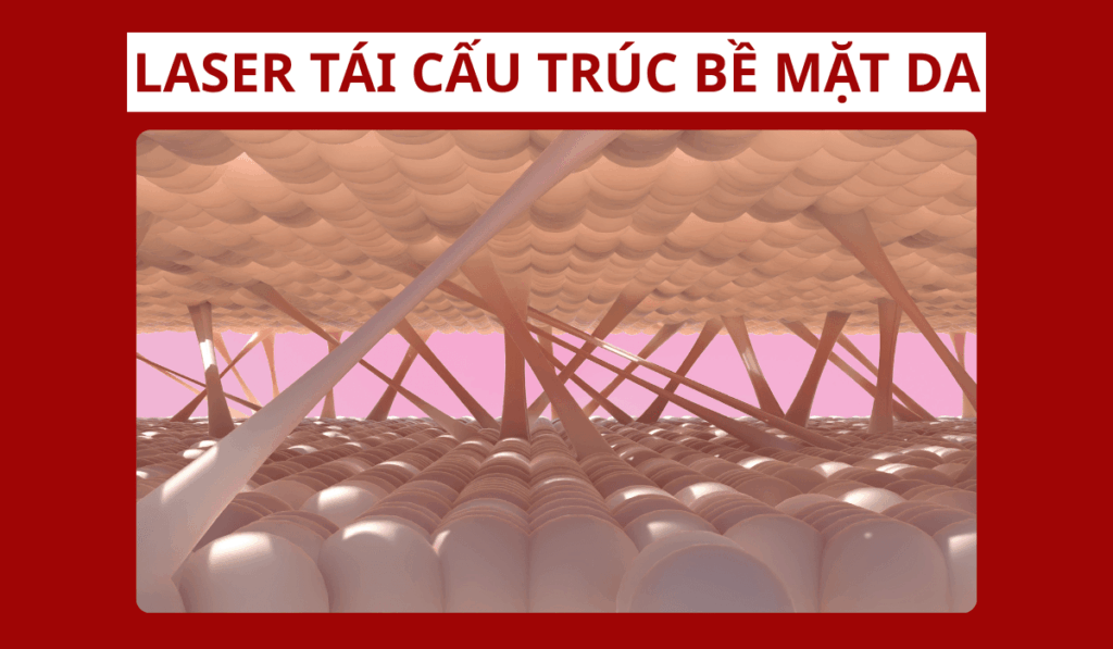Laser sẽ tái cấu trúc bề mặt giúp da mịn màng - căng bóng
