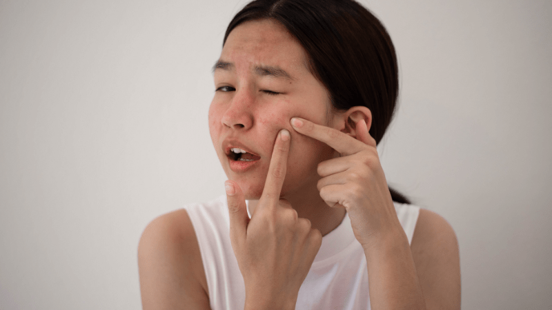 Accure Laser được thiết kế với ba lớp cơ chế bảo vệ