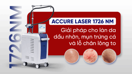 Accure Laser là gì? Gi ải pháp cho làn da dầu mụn