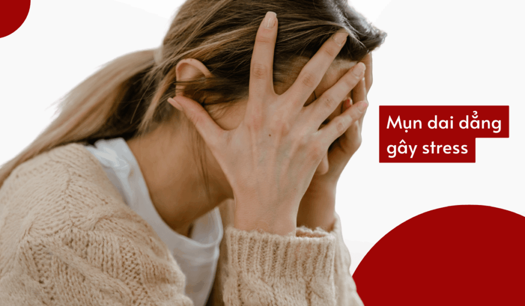 Vòng lặp bế tắc khi trị mụn mãi không khỏi