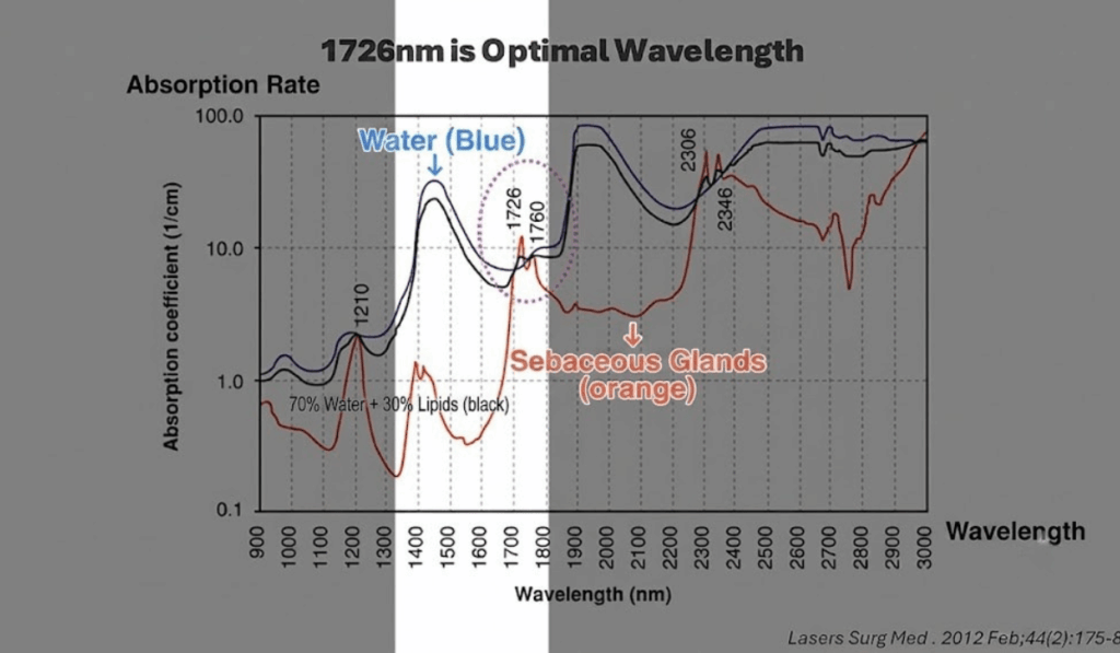 So Sánh Hiệu quả Kiểm Soát Dầu & Trị Mụn: Laser 1450nm vs Laser 1726nm? 2 1726nm là bước sóng tinh chuẩn sau hơn một thập kỷ nghiên cứu