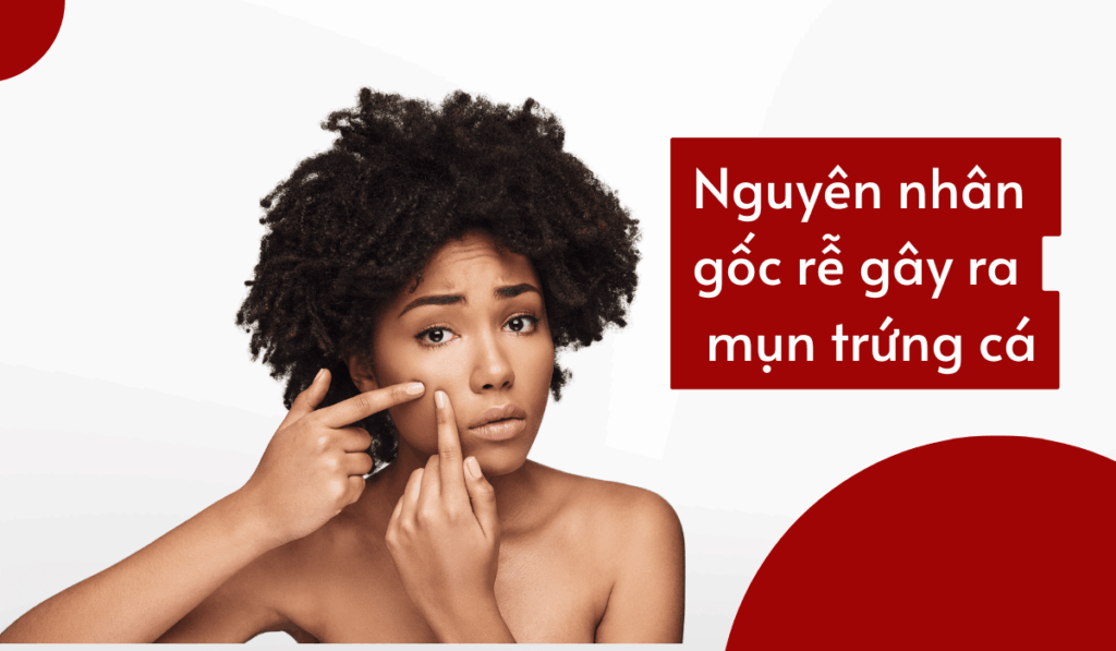 Việc sản sinh dầu quá mức là nguyên nhân gốc rễ của mụn