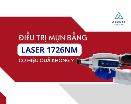 Điều trị mụn bằng laser 1726nm có hiệu quả không? Hiệu quả Accure Laser qua các nghiên cứu lâm sàng Đối với các y bác sĩ da liễu và chủ sở hữu phòng khám (clinic), bài toán điều trị mụn trứng cá nặng, kháng trị hoặc kiểm soát dầu nhờn luôn đi kèm với nhiều thách thức. Các phương pháp truyền thống như kháng sinh dài ngày hay liệu trình uống A-acid thường vướng phải rào cản về tác dụng phụ (khô môi, khô da, ảnh hưởng gan thận, giới hạn ở phụ nữ chuẩn bị mang thai) hoặc tình trạng tái phát cao sau khi ngưng thuốc. Sự ra đời của công nghệ hiệu quả Accure Laser với bước sóng 1726nm đã mở ra một kỷ nguyên mới: điều trị mụn tận gốc, không dùng thuốc. Bài viết này sẽ tổng hợp các cơ sở khoa học và dữ liệu lâm sàng từ chuyên gia để hỗ trợ các B2B partner đánh giá toàn diện giá trị đầu tư của công nghệ này. 1. Cơ sở khoa học và nguyên lý hoạt động của Accure Laser 1726nm Để trả lời câu hỏi liệu công nghệ này có mang lại hiệu quả Accure Laser thực sự hay không, cần nhìn vào tính đặc hiệu của bước sóng trong vật lý quang học. Theo các tài liệu chuyên môn từ chuyên gia, Accure Laser sở hữu bước sóng độc quyền 1726nm – đây là bước sóng nằm ngay tại đỉnh hấp thụ của chất béo (chuỗi CH2) có trong bã nhờn. Hiệu suất hấp thụ của 1726nm đối với dầu nhờn cao hơn khoảng 1.5 đến 2 lần so với nước. Cơ chế chọn lọc: Khi năng lượng laser đi vào da, nó tự động "định vị" và tập trung vào các tuyến bã nhờn nằm sâu ở lớp hạ bì (từ 0.5 đến 1.5 mm), nơi các nang mụn và ổ viêm hình thành. Bảo vệ mô xung quanh: Vì ít hấp thụ nước và melanin hơn so với các bước sóng cũ, năng lượng hoàn toàn không gây tổn thương nhiệt lan tỏa ra các vùng biểu bì lành tính quanh đó. 2. Hiệu quả Accure Laser trên da theo các nghiên cứu lâm sàng Các dữ liệu thử nghiệm lâm sàng ghi nhận những thông số ấn tượng về hiệu quả điều trị thực tế của Accure Laser: Giảm thiểu tổn thương viêm: Sau khi hoàn tất phác đồ chuẩn 4 buổi, các tổn thương viêm giảm trung bình 71% tại mốc theo dõi 3 tháng. Cải thiện tổng thể (12 tuần): Tình trạng mụn trứng cá và tiết dầu được cải thiện khoảng 79% sau 3 tuần/tháng theo dõi. Hiệu quả duy trì dài hạn (52 tuần): Mức độ cải thiện triệu chứng tiếp tục tăng lên đến 90% sau 1 năm theo dõi, cho thấy hiệu quả tiến triển ngay cả sau khi kết thúc liệu trình. Độ bền vững kéo dài: Một số trường hợp ghi nhận hiệu quả ổn định rõ rệt lên đến 35 tháng (gần 3 năm) sau khi ngưng điều trị. Bên cạnh đó, cơ chế tác động cốt lõi của Accure Laser là trực tiếp làm biến đổi có kiểm soát cấu trúc tuyến bã nhờn (thay vì chỉ ức chế tạm thời), giúp giải quyết triệt để vấn đề từ gốc và ngăn ngừa tái phát. Đặc biệt, theo báo cáo tại hội nghị học thuật ASLMS, công nghệ này còn thể hiện hiệu quả rõ rệt đối với các tổn thương không viêm: mụn đầu đen giảm khoảng 47.1% và mụn nang giảm khoảng 46.4%, với kết quả cải thiện đáng kể đạt được trung bình chỉ sau 2.7 buổi điều trị. Hình trang 7 https://dr-skin.com.tw/accure_1726_acne/#Accure_%E6%B2%B9%E6%93%8A%E9%9B%B7%E5%B0%84%E7%9A%84%E7%99%82%E6%95%88%EF%BC%8C%E8%87%A8%E5%BA%8A%E6%95%B8%E6%93%9A%E6%80%8E%E9%BA%BC%E8%AA%AA%EF%BC%9F 3. Công nghệ thông minh và tính an toàn trong thực hành lâm sàng Rủi ro tai biến hoặc bỏng nhiệt là yếu tố cần tránh được quan tâm đặt lên hàng đầu. Accure Laser giải quyết triệt để bài toán này nhờ tích hợp hệ thống kỹ thuật tiên tiến: Hệ thống AI kiểm soát nhiệt độ thời gian thực (Treat-to-Temperature): Thiết bị tích hợp camera nhiệt quét với tần số lên đến 35 khung hình/giây, giám sát nhiệt độ biểu bì liên tục. Ngay khi nhiệt độ đạt ngưỡng tối ưu để làm teo tuyến bã nhờn nhưng vẫn giữ an toàn tuyệt đối cho lớp sừng, hệ thống sẽ tự động điều chỉnh hoặc ng tắt năng lượng. Bảo vệ tối ưu cho mọi type da: Do không nhắm mục tiêu vào sắc tố melanin, công nghệ này an toàn cao với cả các type da tối màu, giảm thiểu tối đa nguy cơ tăng sắc tố sau viêm (PIH) hay sẹo lõm. Các đối tượng chỉ định lâm sàng phù hợp: Bệnh nhân kháng trị lâu năm: Những người đã trải qua nhiều phác đồ nhưng mụn vẫn tái phát liên tục, cần giải pháp tác động sâu vào gốc tuyến bã nhờn. Người chống chỉ định với thuốc uống toàn thân: Phù hợp với phụ nữ chuẩn bị mang thai hoặc người gặp tác dụng phụ nặng khi dùng kháng sinh. Tình trạng tăng tiết bã nhờn trầm trọng: Xử lý triệt để da dầu thừa, lỗ chân lông thô giãn, sợi bã nhờn và mụn đầu đen/đầu trắng. Mụn bọc dạng nang và mụn cứng đầu: Giải quyết hiệu quả các ổ viêm nằm sâu dưới lớp hạ bì mà laser thông thường khó chạm tới. Nhìn chung, những dữ liệu khoa học và thực tế lâm sàng đã cho thấy hiệu quả Accure Laser 1726nm thực sự là bước tiến đáng chú ý, giúp giải quyết triệt để nguyên nhân gây mụn từ gốc mà không cần lạm dụng thuốc hay các liệu pháp xâm lấn phức tạp. Đầu tư vào một công nghệ thông minh, an toàn và mang lại trải nghiệm nhẹ nhàng cho khách hàng chính là cách để các phòng khám da liễu tạo ra dấu ấn riêng, đồng thời nâng tầm chất lượng dịch vụ chuyên khoa. Quý bác sĩ và chủ clinic quan tâm đến phác đồ, chính sách chuyển giao hoặc các tài liệu nghiên cứu chi tiết của Accure Laser, có thể kết nối ngay với chúng tôi để cùng trao đổi sâu hơn.